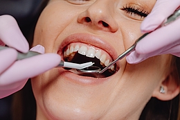 Zahnfleischrückgang vermeiden